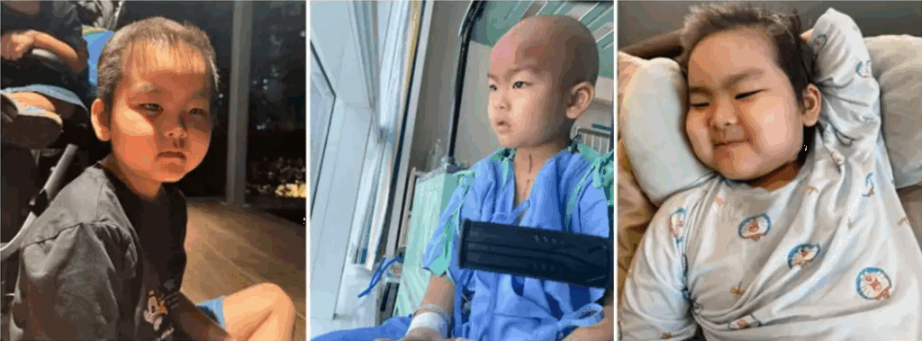 5歳男児チャーリー、23CでNK細胞療法を受け改善と報道